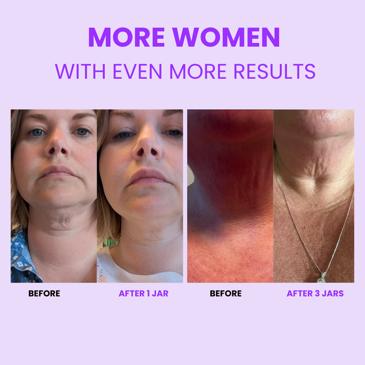 Tighten Lift Neck Cream